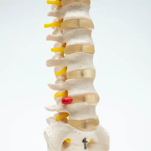 COL 1107 - Coluna Vertebral Flexível - Image 3