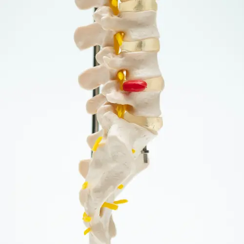 COL 1107 - Coluna Vertebral Flexível - Image 4