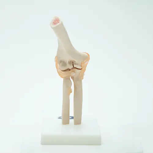 COL 1112 - Articulação do Cotovelo com Ligamentos - Image 4