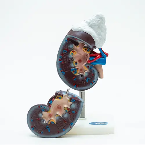 COL 1310 - Rim Humano c/Glandula Renal 3 partes - Image 3